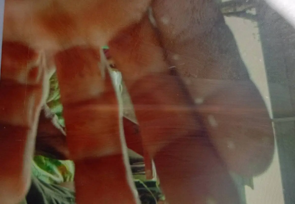 ลุงวัย 59 จู่ๆ มีหนอนไต่ออกมาตามตัว รู้ว่าไปทำอะไรมาน่าเห็นใจ