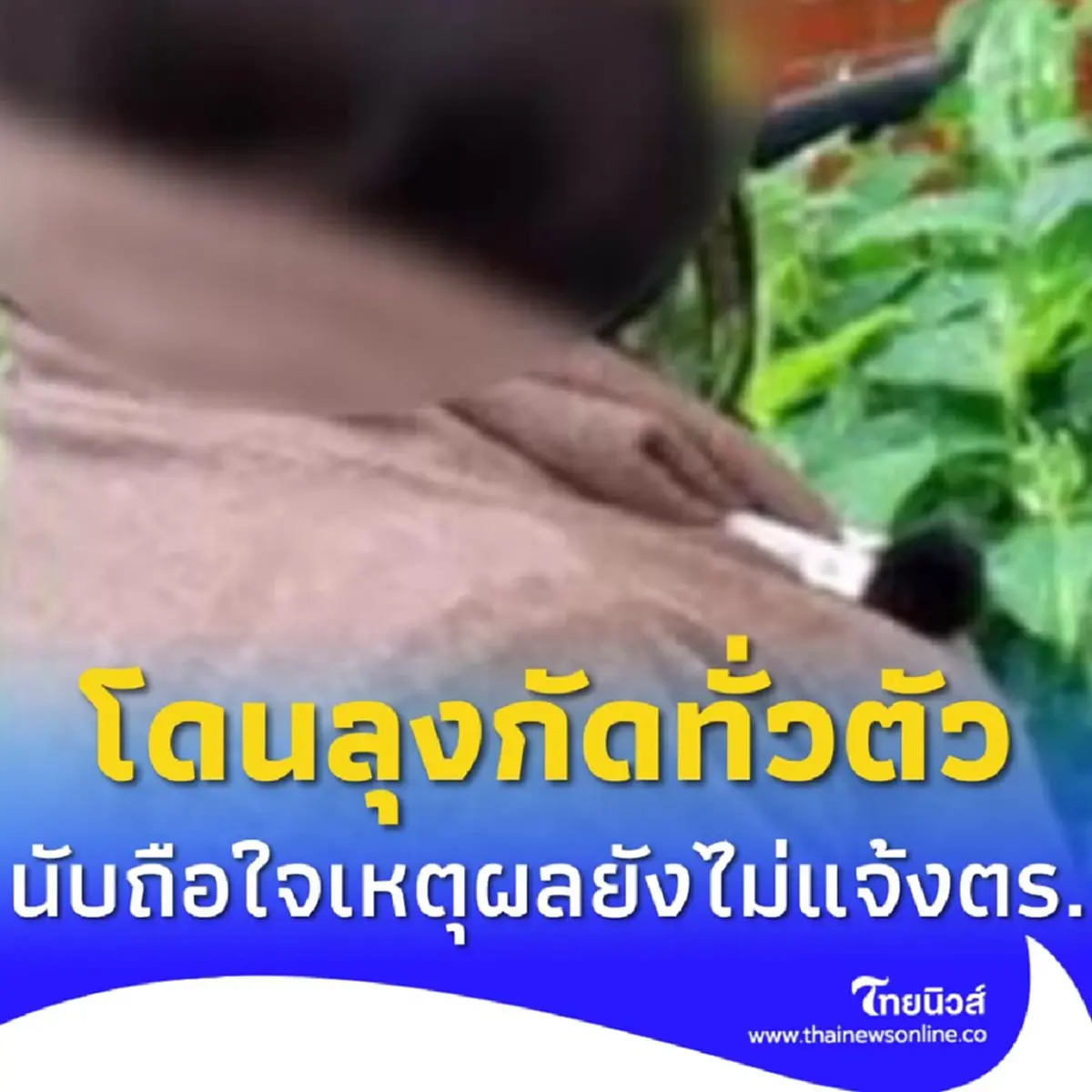 แม่เลี้ยงเดี่ยวเล่า โดนลุงขายเฉาก๊วยกัด บอกเหตุผลยังไม่แจ้งตร.