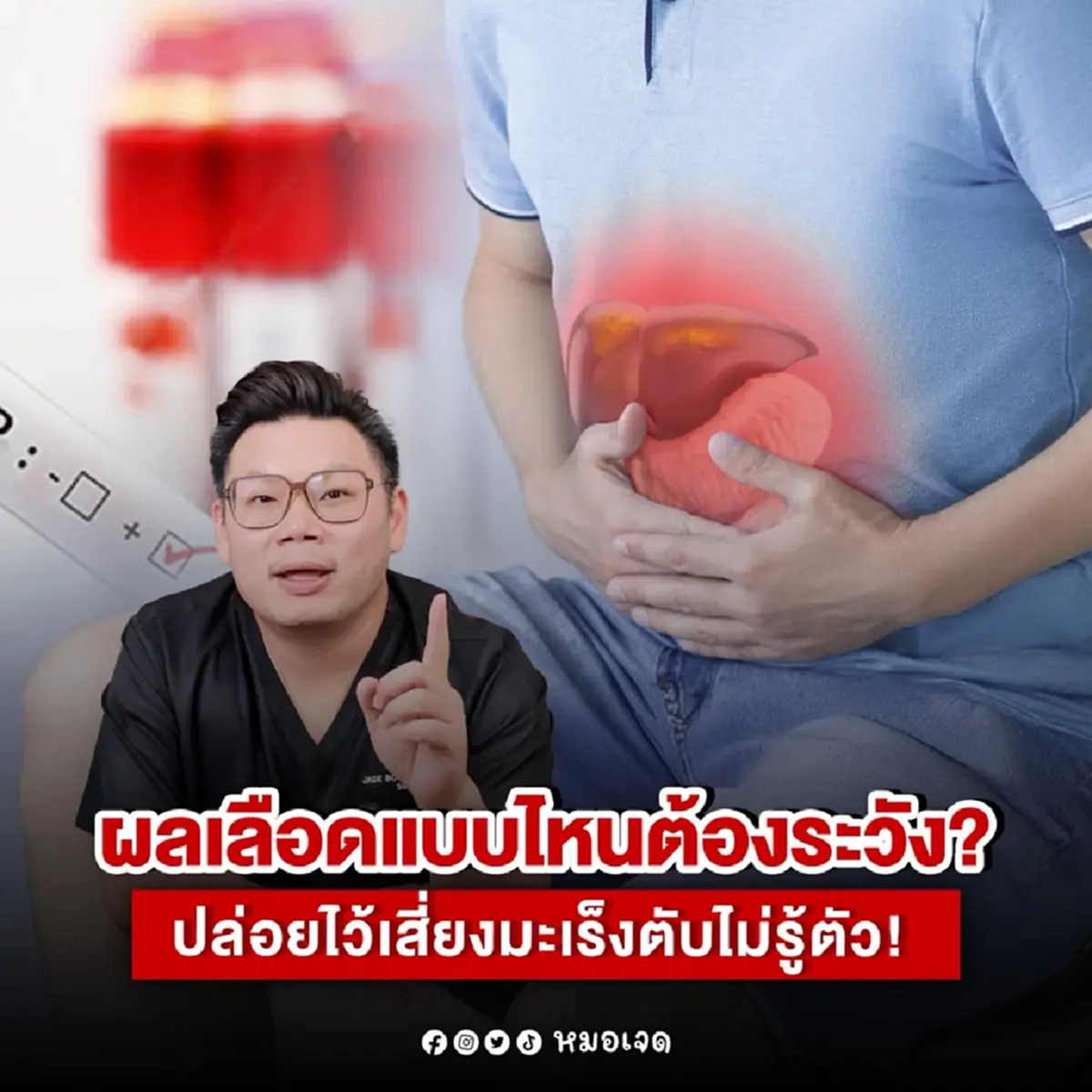 เผยชัดแล้ว ผลเลือด แบบไหน ปล่อยไว้เสี่ยงมะเร็งตับไม่รู้ตัว
