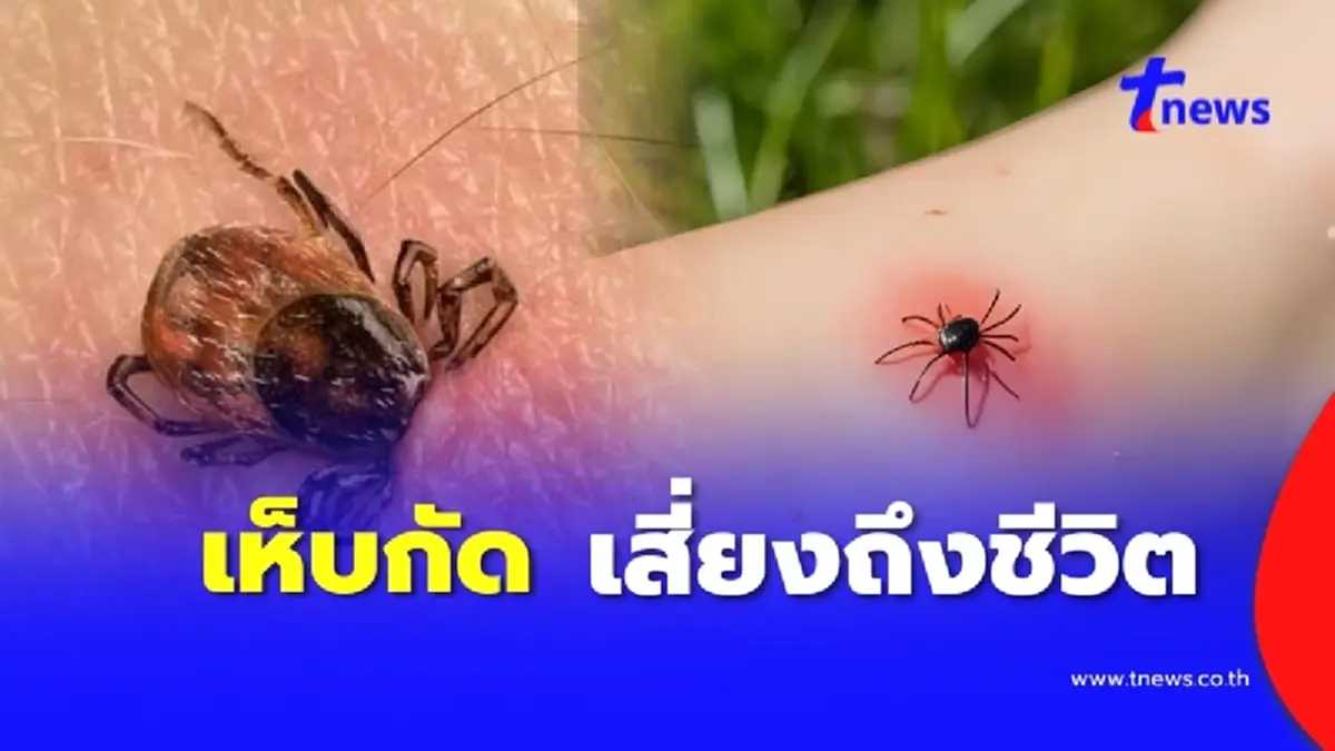 ของจริง โดน เห็บกัด เสี่ยงถึงขั้นเสียชีวิตจากเชื้อไวรัส