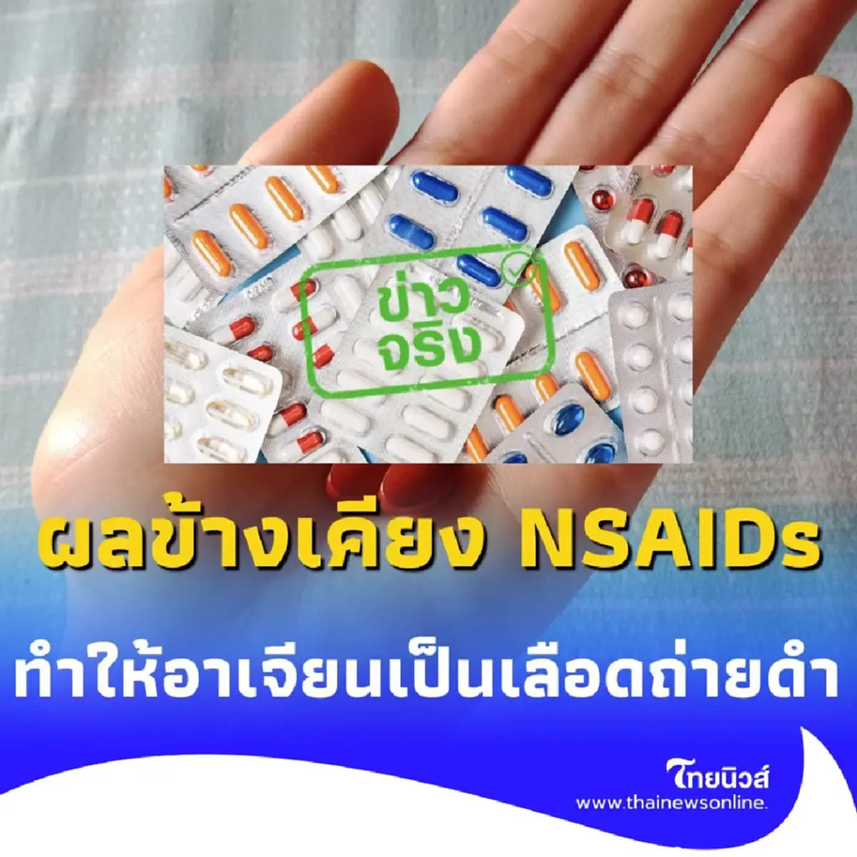 ผลข้างเคียงจากการใช้ยา NSAIDs ต่อเนื่อง อาจทำให้อาเจียนเป็นเลือด-ถ่ายดำ