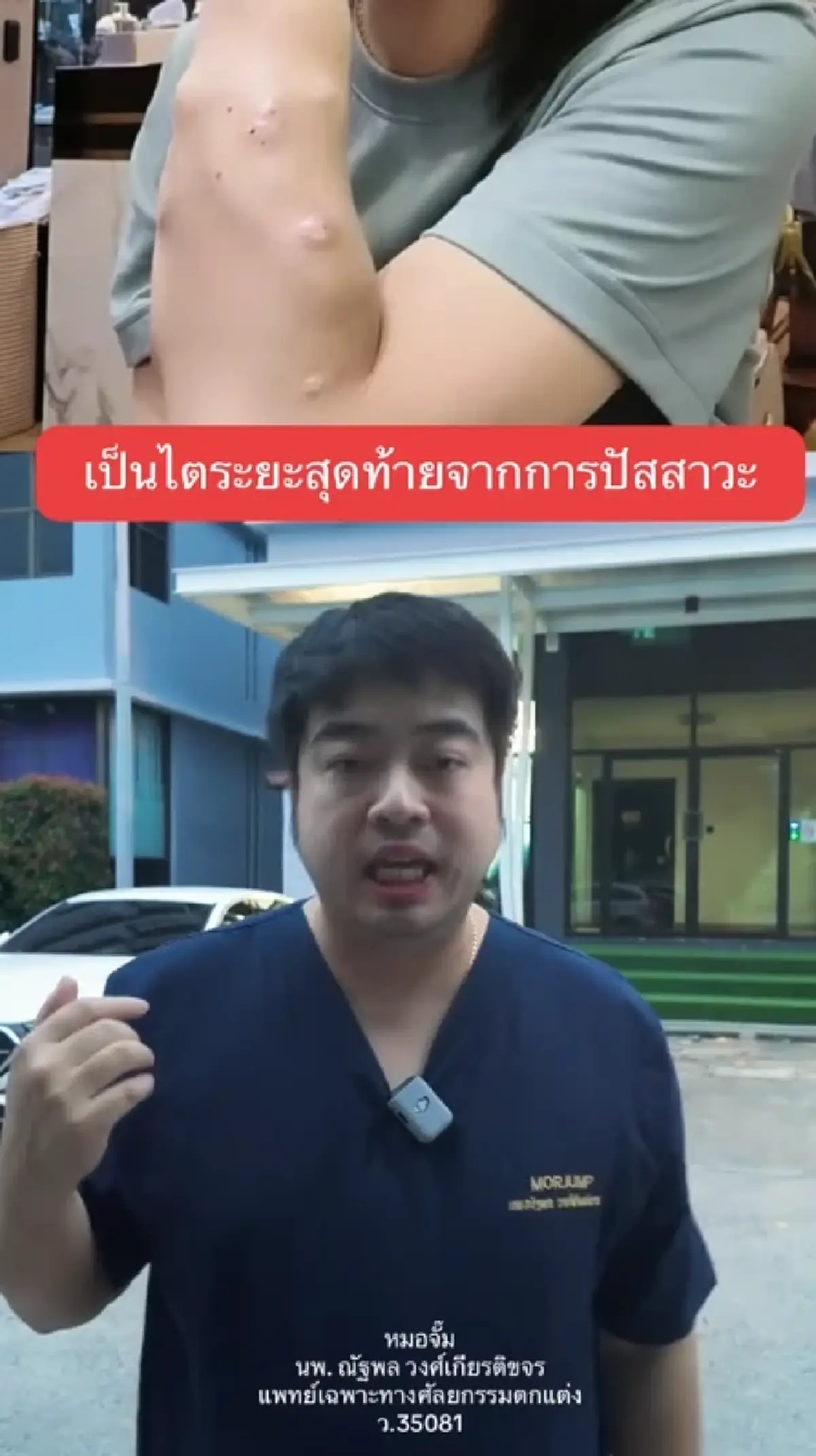 หมอจั๊มเตือน 4 พฤติกรรมเสี่ยง เกิดจากปัสสาวะ ถึงขั้นไตวาย