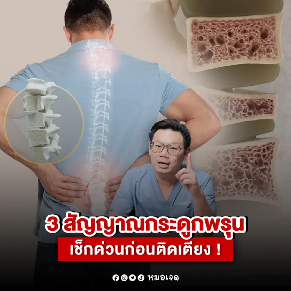 เปิด 3 สัญญาณกระดูกพรุน ใครไม่อยากติดเตียง ต้องรู้ หมอเผยเอง