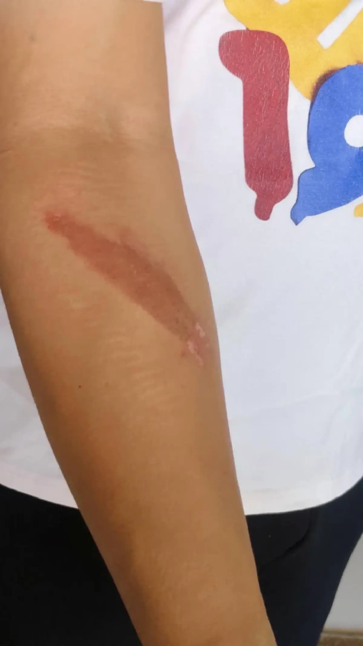 สุดเดือด หนุ่มโดน 20 คน รุมยำกลางร้านดัง รู้สาเหตุยิ่งตกใจ