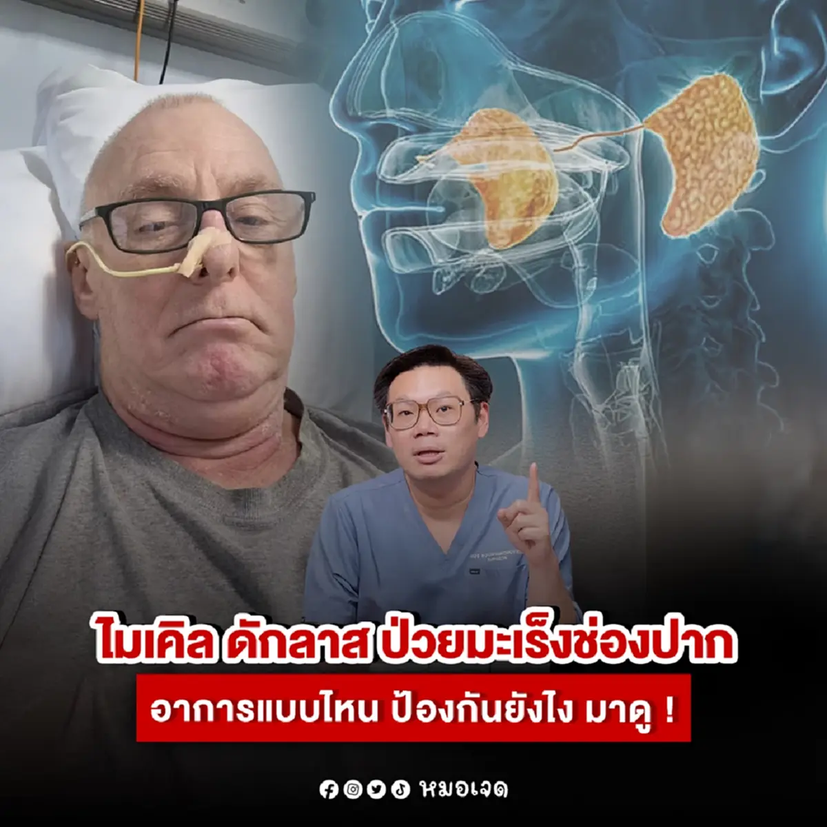 เปิดอาการเริ่มต้น มะเร็งช่องปาก หลายคนมี แต่ อาจไม่รู้ตัว 