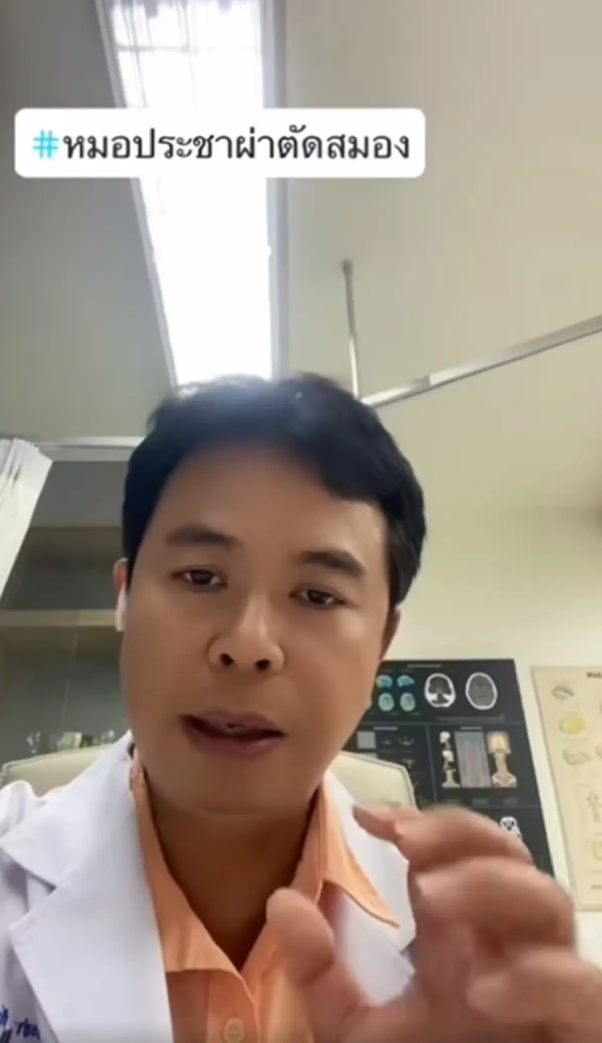 หมอเผยเคสหญิงดื่มกาแฟแล้วใจสั่น แขนขาอ่อนแรง ตรวจพบสมองขาดเลือด