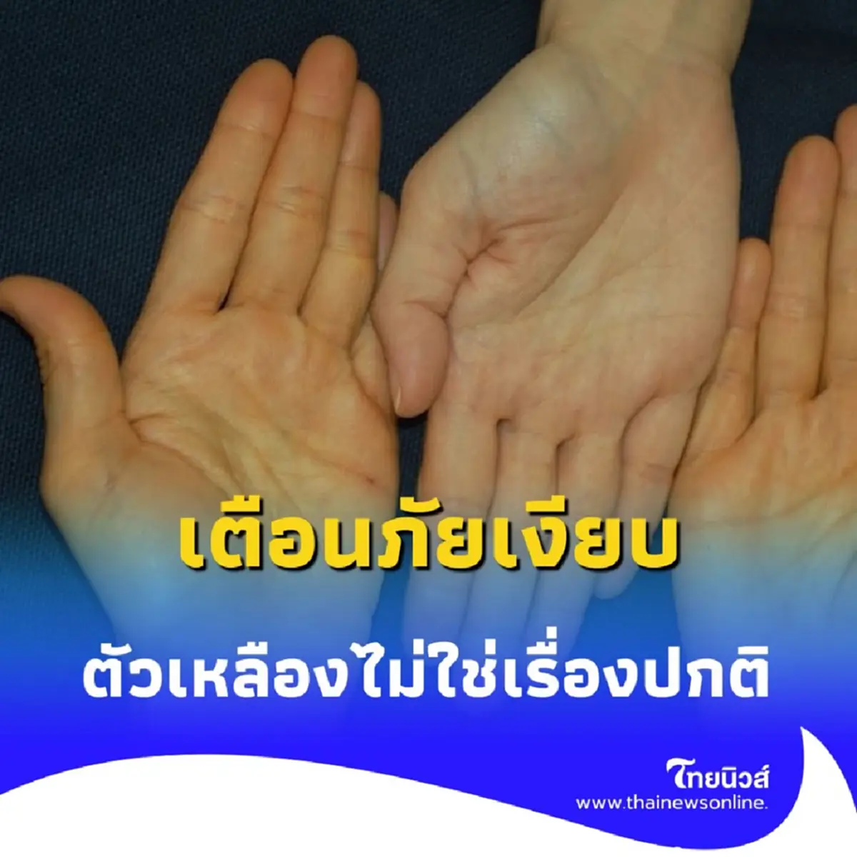 เตือนภัยเงียบ ผิวเหลืองเมื่อแก่ อาจไม่ใช่แค่ชราภาพธรรมดา