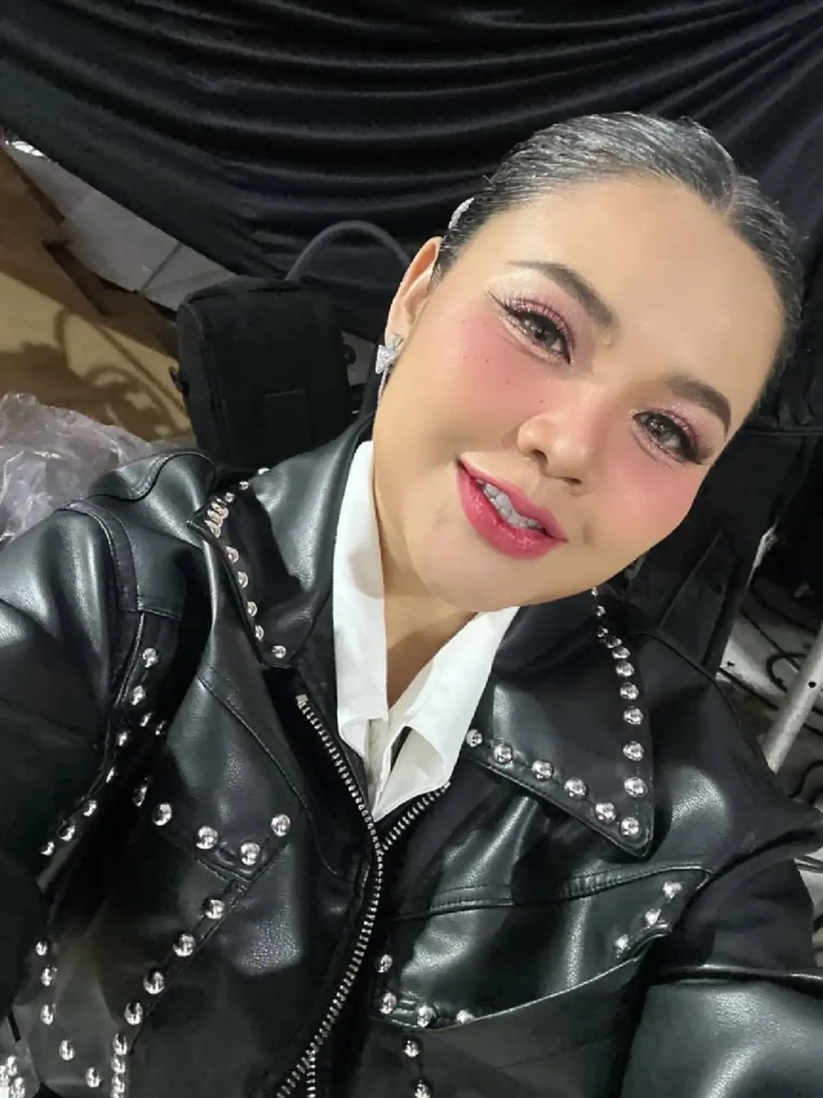 หน้าวีขั้นสุด ตั๊กแตน ชลดา ทำศัลยกรรมครั้งใหญ่ หน้าเด็กลงมาก