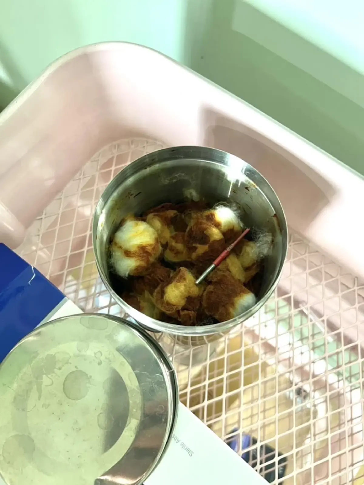 เปิดสภาพ 2 คลินิกดัง โดนบุกจับ ฉีดเพิ่มขนาด-ขลิบเจ้าโลก สุดสกปรก