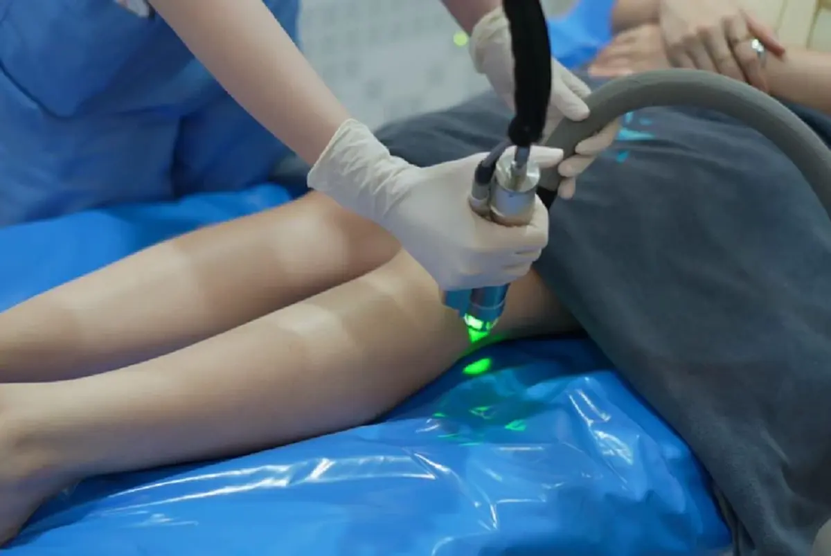Yag laser กำจัดขน