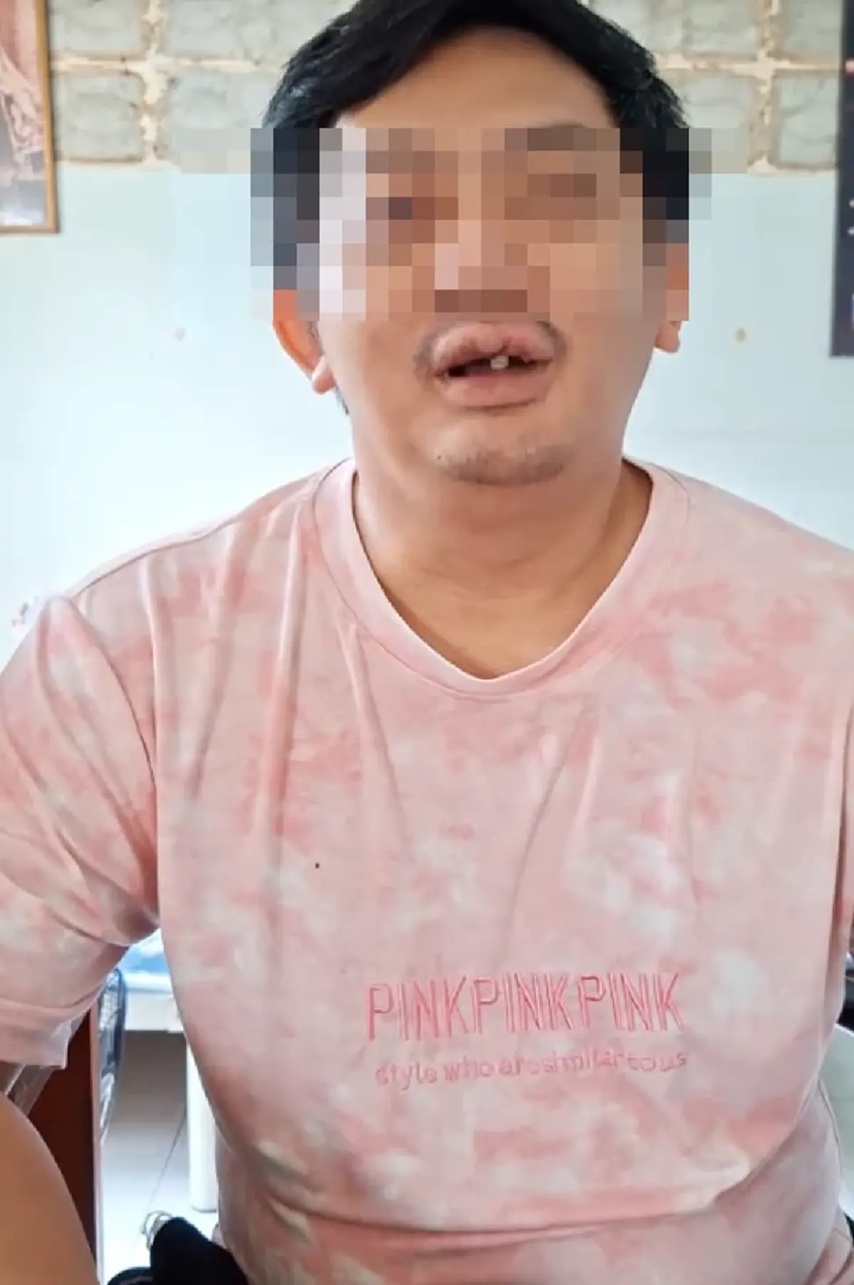 หนุ่มโชคร้าย ตาบอดเพราะแพ้ยาแก้อักเสบ กินเม็ดเดียวเปลี่ยนชีวิต