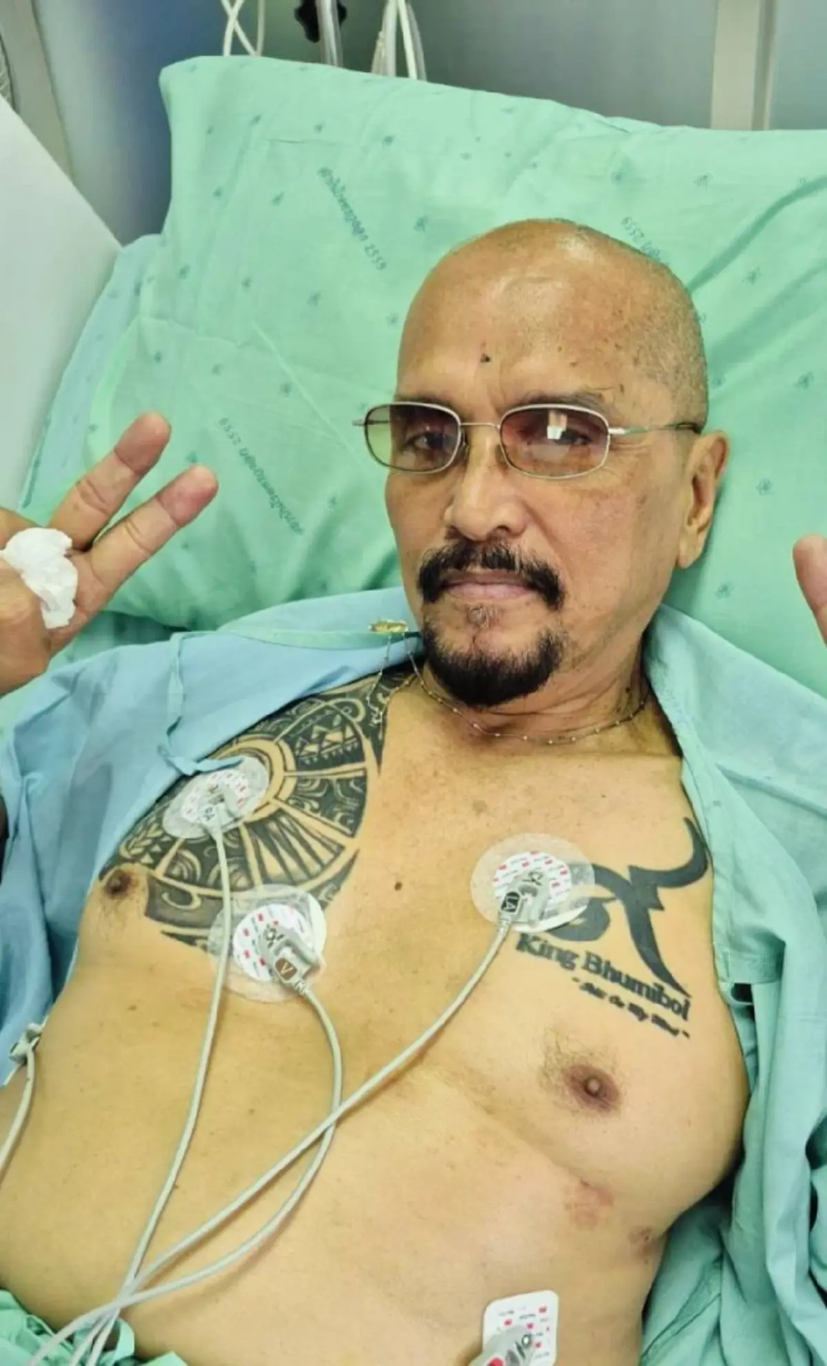 "เล็ก ทีโบน" เล่านาทีชีวิต เจ็บกลางอกเฉียบพลัน ต้องผ่าตัดด่วน