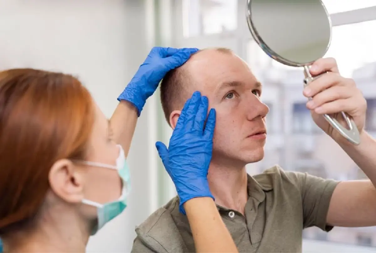 ปลูกผม fue คือ