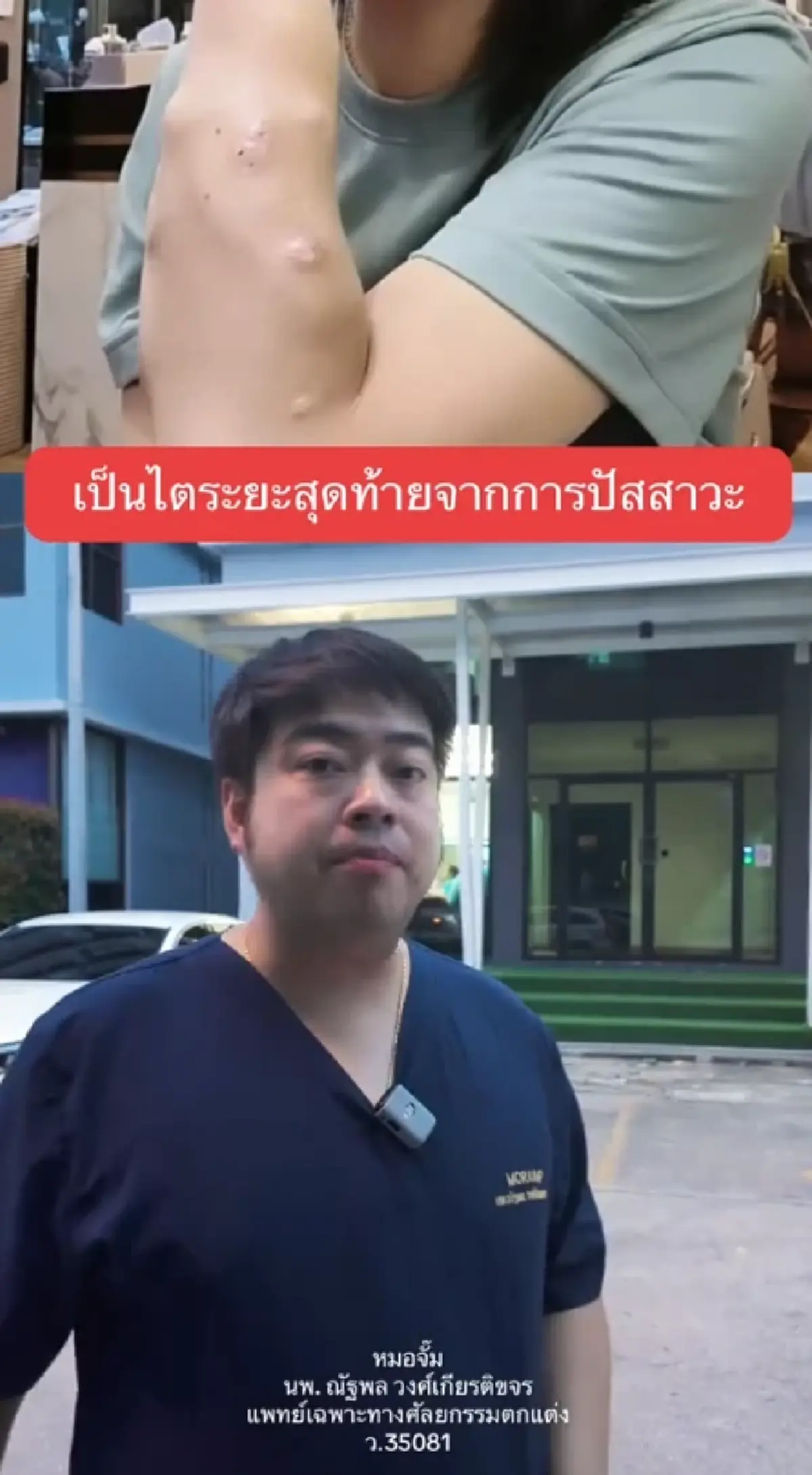 หมอจั๊มเตือน 4 พฤติกรรมเสี่ยง เกิดจากปัสสาวะ ถึงขั้นไตวาย