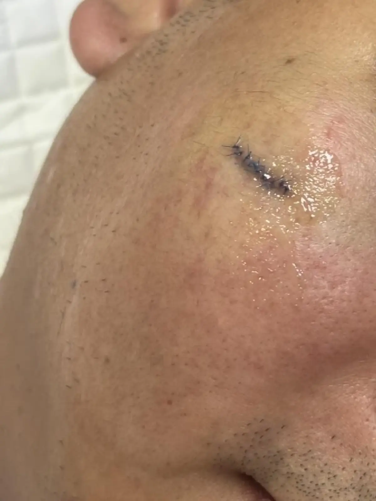 สุดเดือด หนุ่มโดน 20 คน รุมยำกลางร้านดัง รู้สาเหตุยิ่งตกใจ