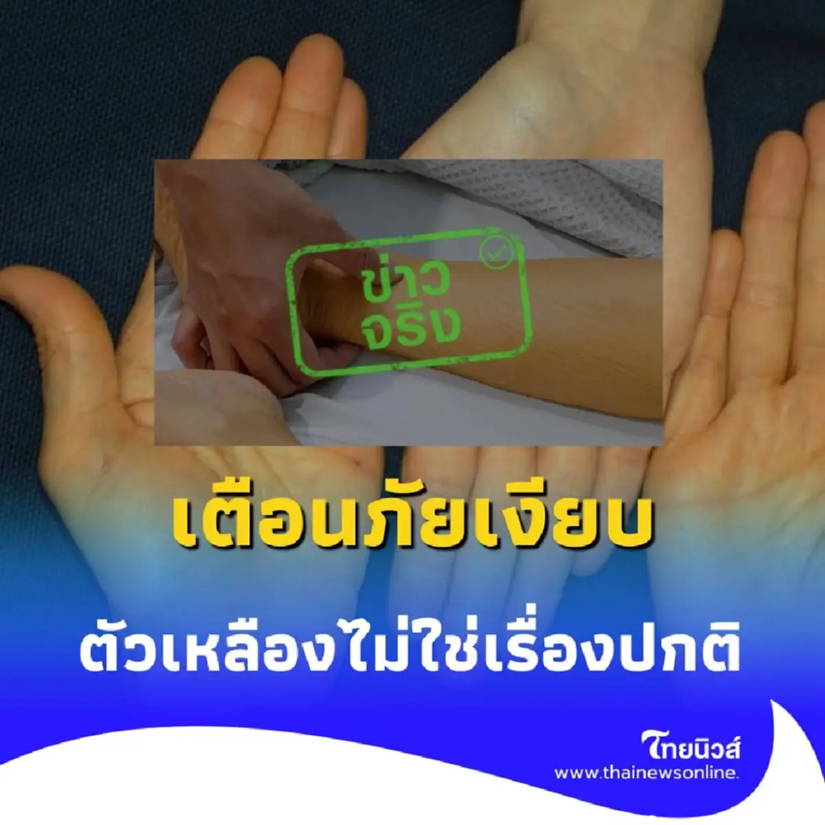 เตือนภัยเงียบ ผิวเหลืองเมื่อแก่ อาจไม่ใช่แค่ชราภาพธรรมดา