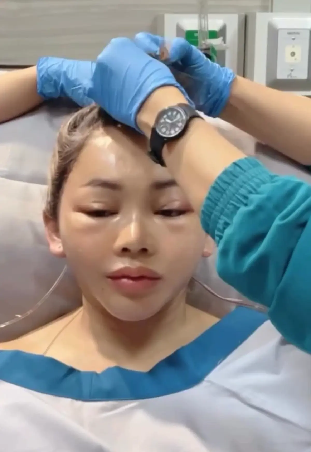 หน้าวีขั้นสุด ตั๊กแตน ชลดา ทำศัลยกรรมครั้งใหญ่ หน้าเด็กลงมาก