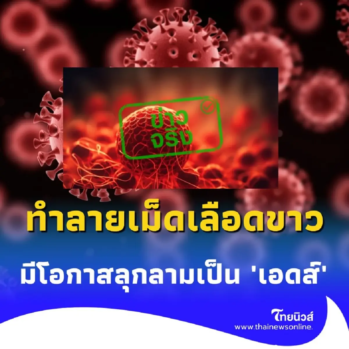 เชื้อ HIV ทำลายเม็ดเลือดขาว หากไม่รักษามีโอกาสลุกลามเป็น เอดส์