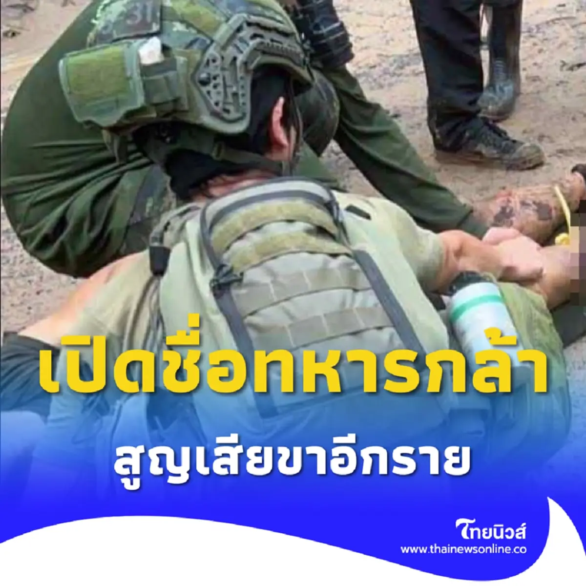 เปิดชื่อทหารกล้า สูญเสียขาหลังเหยียบกับระเบิดใกล้ปราสาทตาควาย