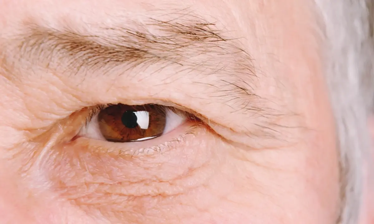 วุ้นในตาเสื่อม อันตรายหรือไม่? สัญญาณเตือนที่ไม่ควรมองข้าม