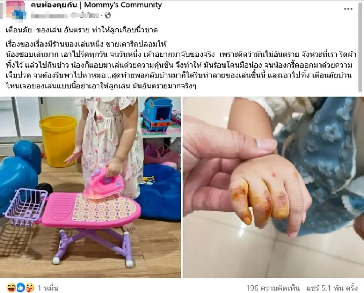 คดีพลิก ลูกเจ็บหนัก โทษของเล่นอันตราย งานนี้คอมเมนต์เดือด