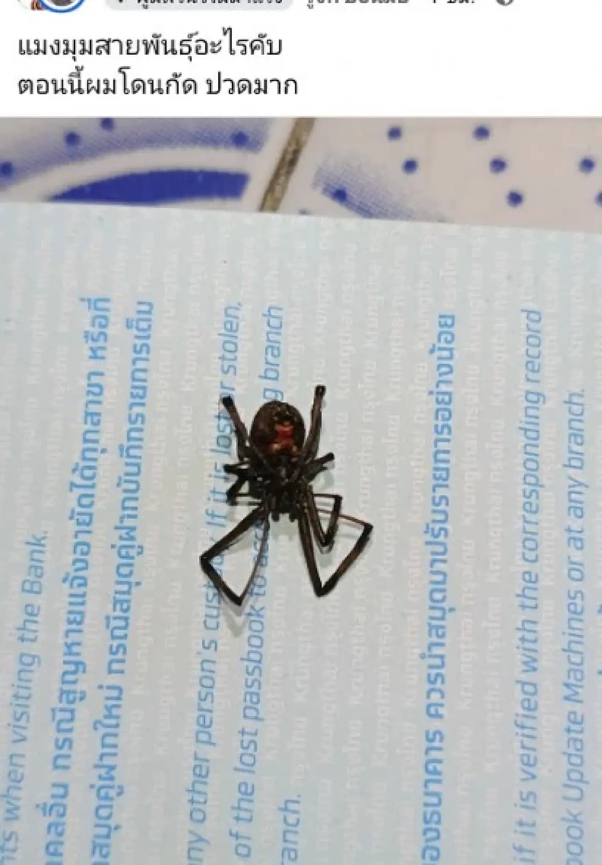 หนุ่มปวดสาหัส หลังโดน แมงมุมปริศนา กัด ก่อนสุดท้ายรู้ความจริง 