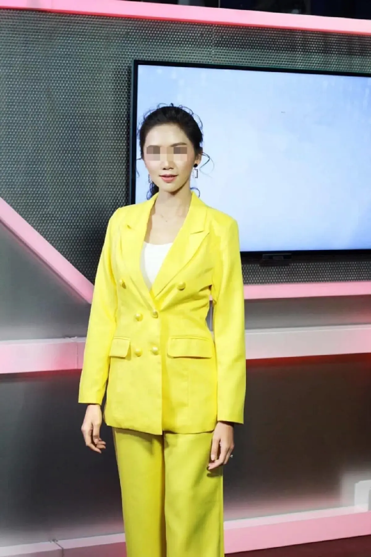 อดีตผู้ประกาศดัง เจอพิษหมอเก๊ ฉีดยาเถื่อนให้จนหน้าพัง