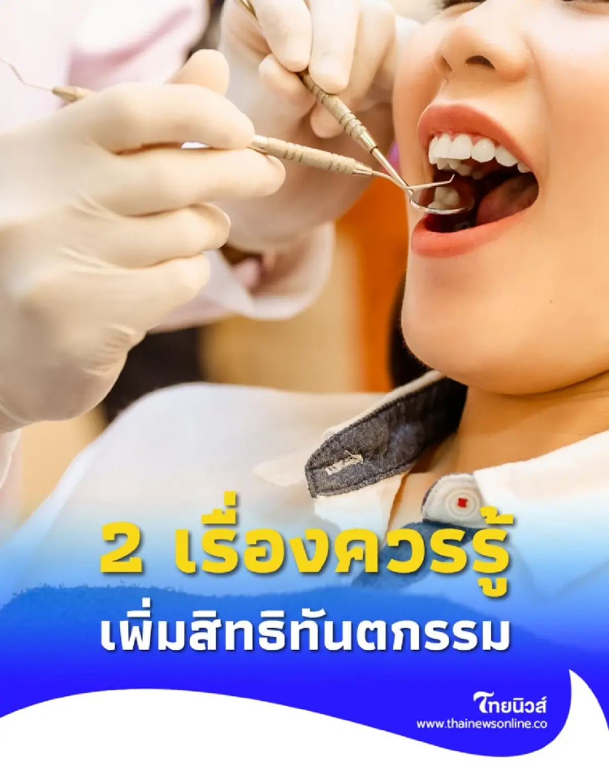 เช็ก 2 เรื่องควรรู้ ประกันสังคมเพิ่มสิทธิทันตกรรม มีหลักเกณฑ์อะไรบ้าง