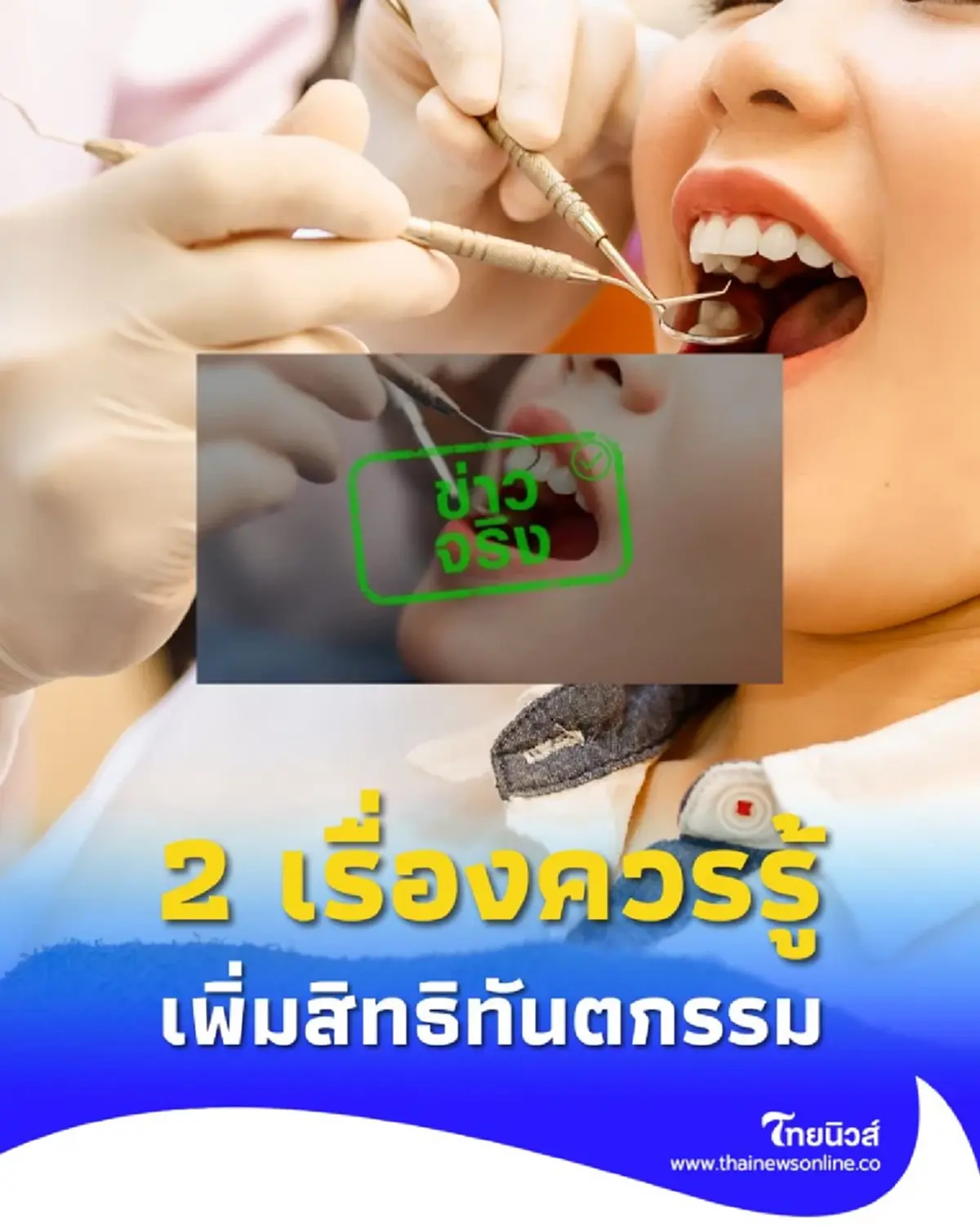 เช็ก 2 เรื่องควรรู้ ประกันสังคมเพิ่มสิทธิทันตกรรม มีหลักเกณฑ์อะไรบ้าง