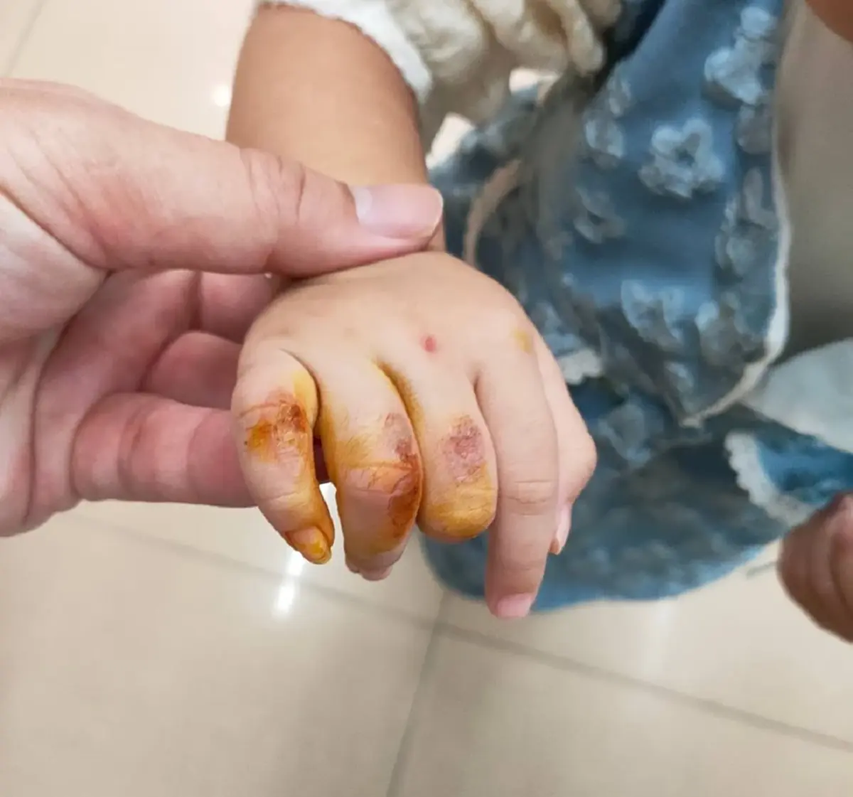 คดีพลิก ลูกเจ็บหนัก โทษของเล่นอันตราย งานนี้คอมเมนต์เดือด