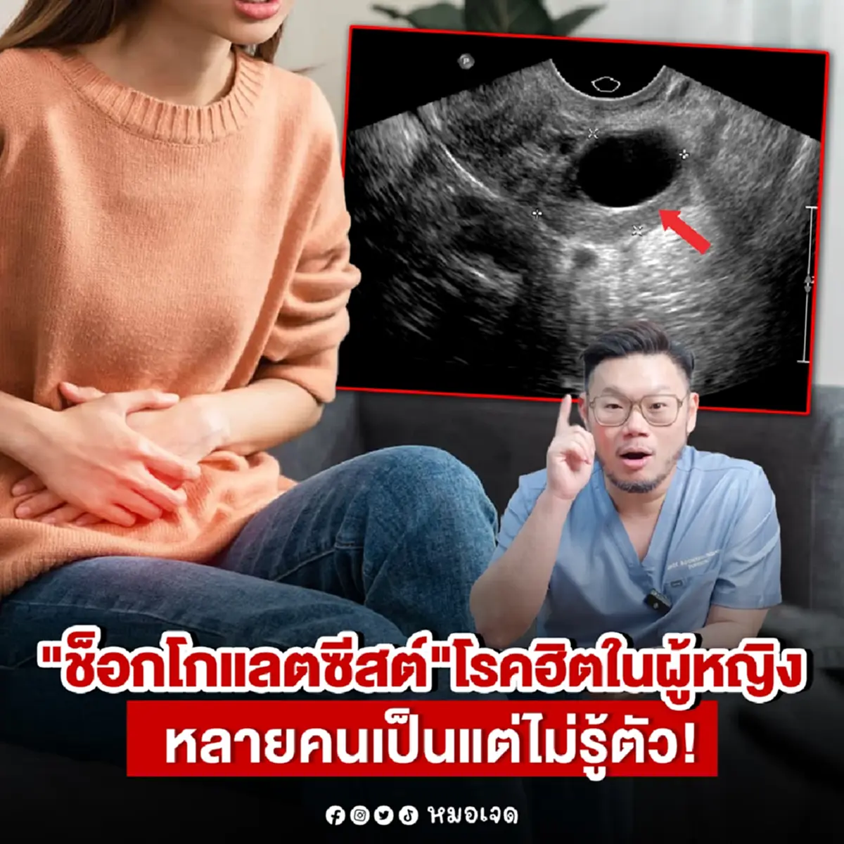 เปิดอาการเบื้องต้น ช็อกโกแลตซีสต์ ใครมีดังนี้ ไปหาหมอด่วน 