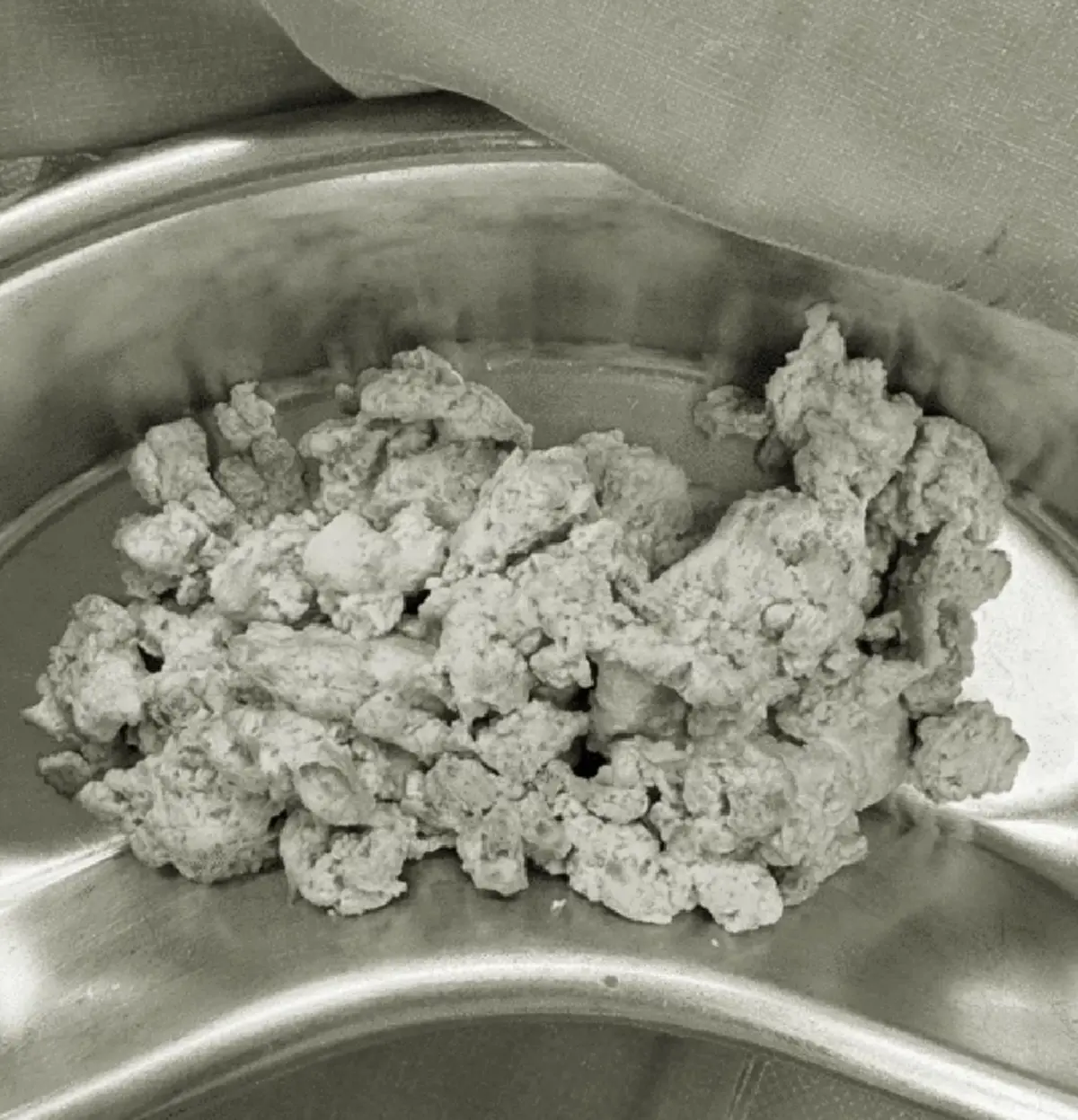 เตือนใครชอบกิน ปูดิบ กุ้งดิบ หลัง สาว 14 เจอหนองในช่องเยื่อหุ้มปอด