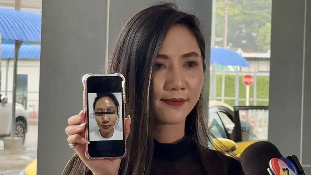 อดีตผู้ประกาศดัง เจอพิษหมอเก๊ ฉีดยาเถื่อนให้จนหน้าพัง