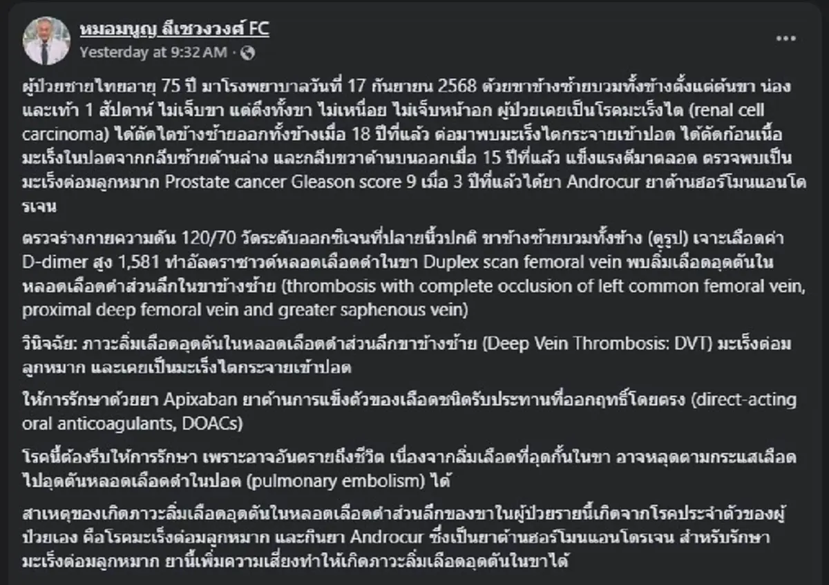 หมอมนูญ เปิดเคส ชายขาซ้ายบวมทั้งขา ก่อนเจอต้นตอ สุดอันตราย 