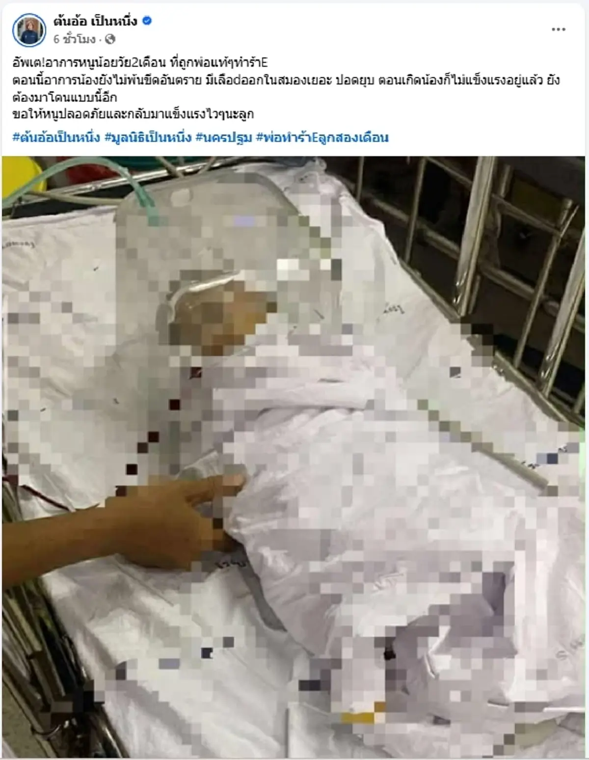 สลดใจ พ่อโหดทำร้ายลูก 2เดือนประชดเมีย อาการสาหัสยังไม่พ้นวิกฤต