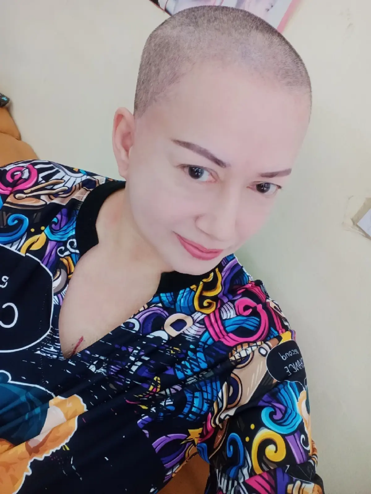 ยิ้มสู้ อดีตนักแสดงดัง โกนผมเตรียมรักษามะเร็งปอด แฟนๆ ส่งกำลังใจ