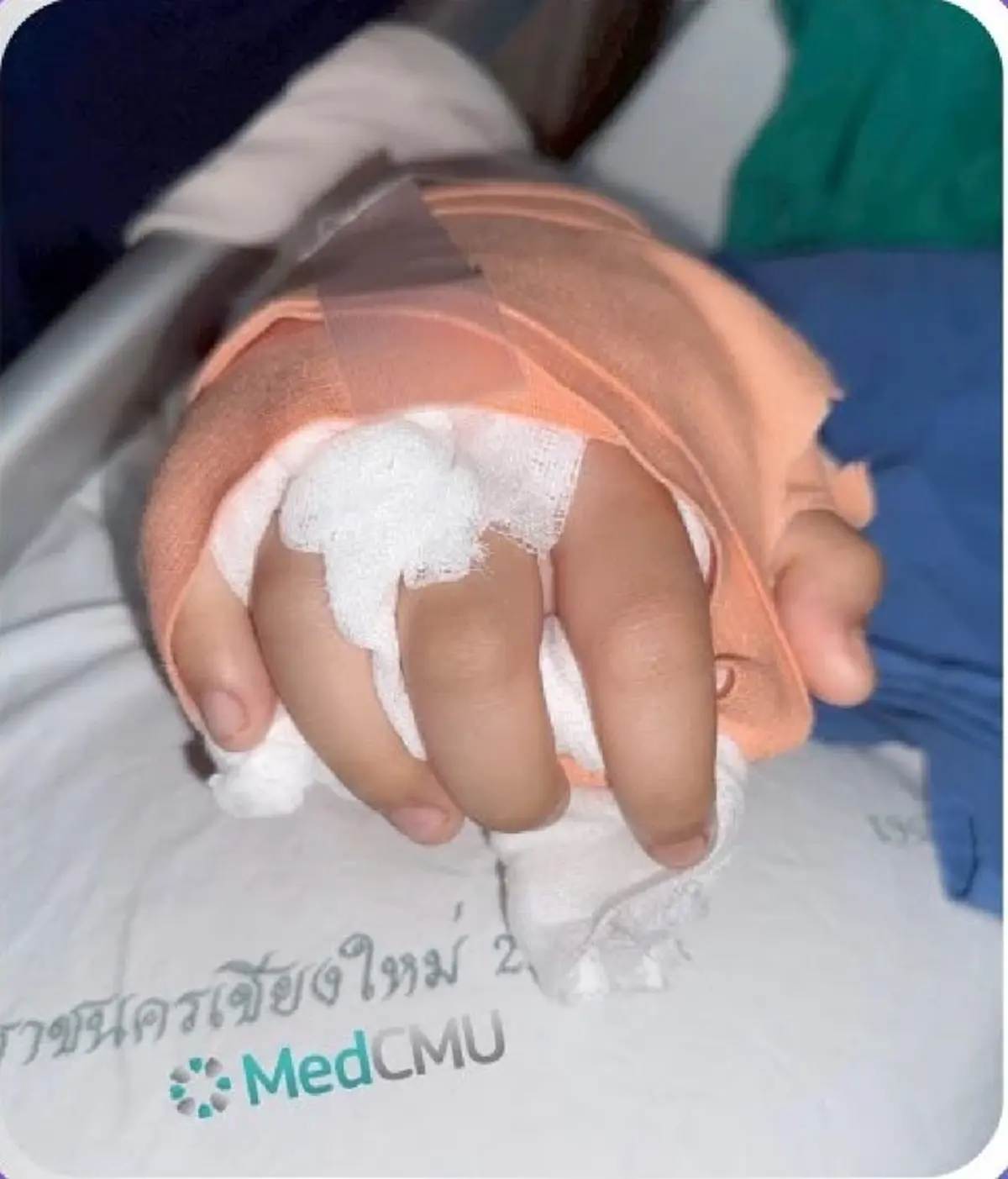 มีข่าวดี อาการล่าสุด เด็กหญิง14ปี ถูกแก๊งไทยใหญ่ฟันข้อมือขาด