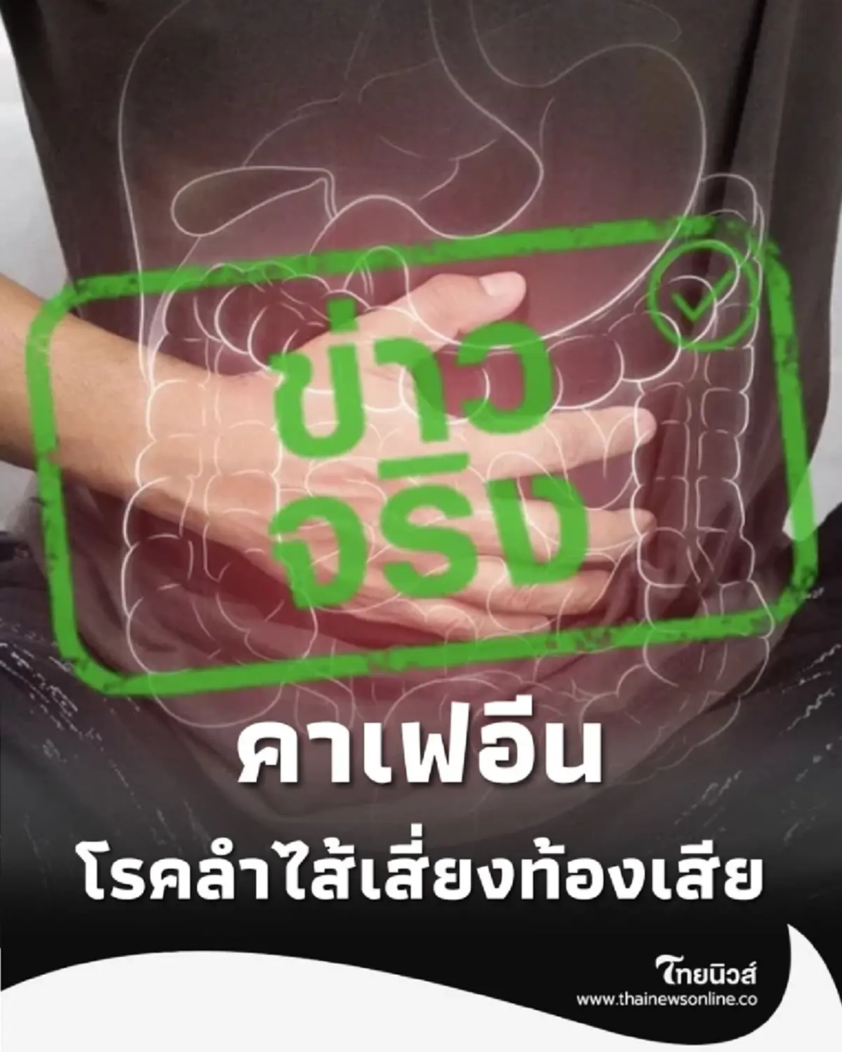 คนรักกาแฟต้องรู้ คาเฟอีนทำพิษ โรคลำไส้เสี่ยงท้องเสีย ปวดเกร็ง