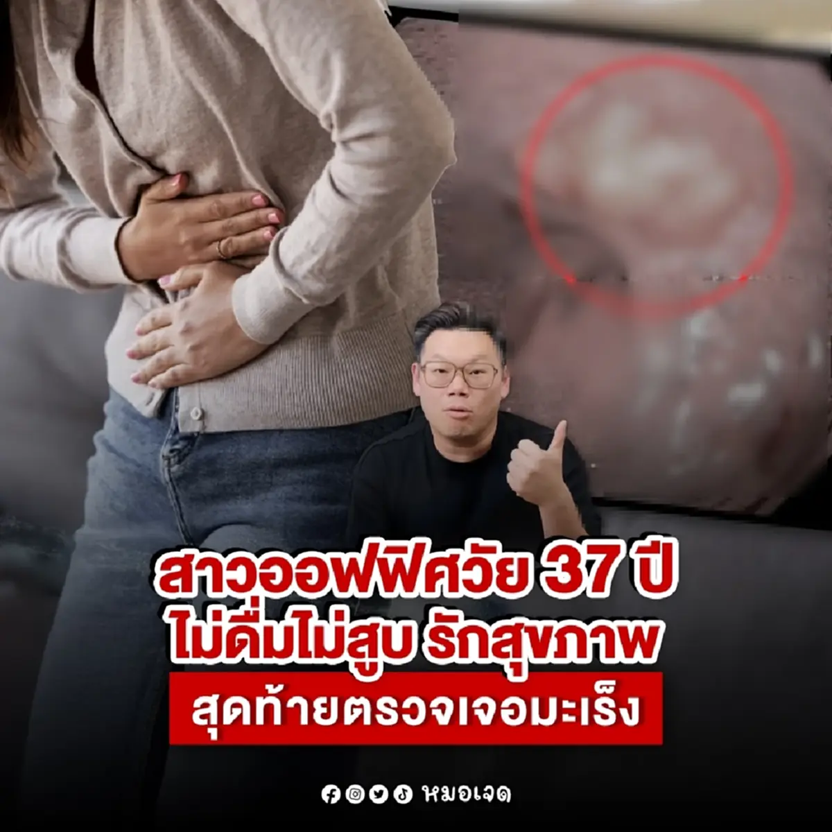 น่าตกใจ สาว37ออกกำลังกาย กินคลีน เจอมะเร็งลำไส้ จากพฤติกรรมเล็กๆ