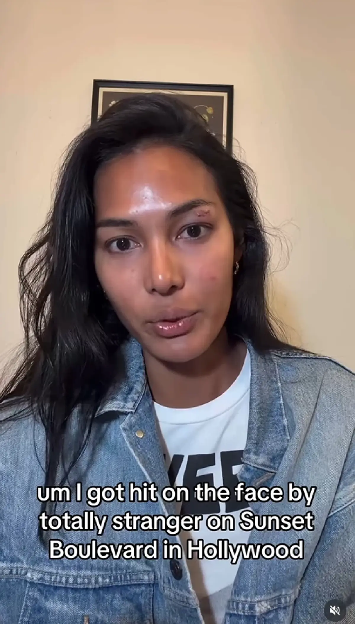 "นางแบบไทย" เผยนาทีระทึก ถูกคนแปลกหน้าทำร้ายกลางลอสแอนเจลิส