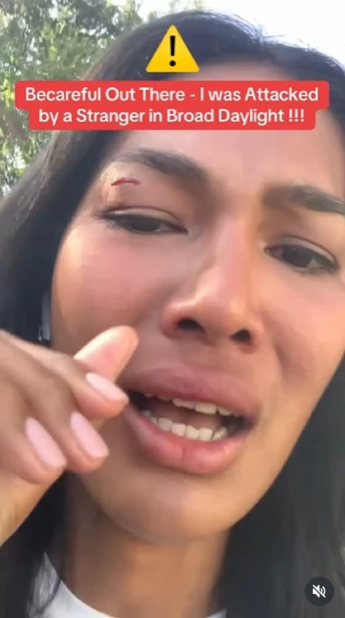 "นางแบบไทย" เผยนาทีระทึก ถูกคนแปลกหน้าทำร้ายกลางลอสแอนเจลิส