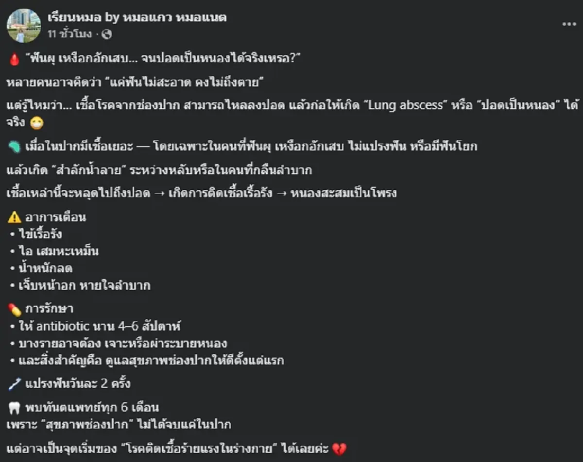ไม่ใช่เรื่องเล็ก หมอเตือน ฟันผุ – เหงือกอักเสบ เสี่ยงรุนแรงถึงดับ
