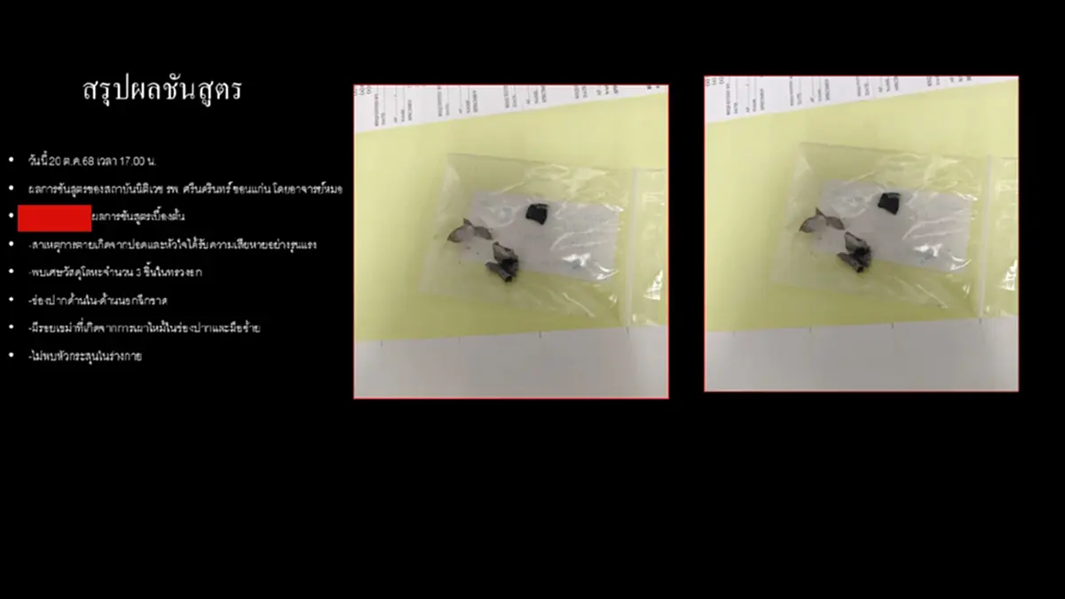 อุทาหรณ์ชั้นดี บุหรี่ไฟฟ้าระเบิด ทำหนุ่ม47 ดับคาที่ 