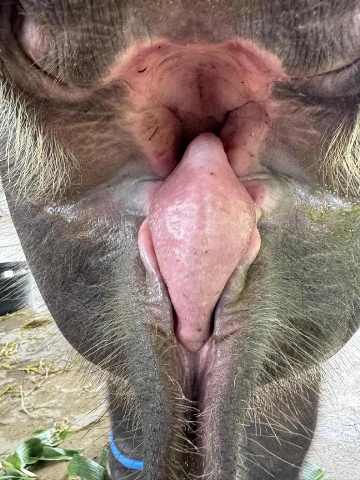 ข่าวดี อัปเดต น้องต้นหนาว ล่าสุด ยอมเลยหัวใจนักสู้ของจริง