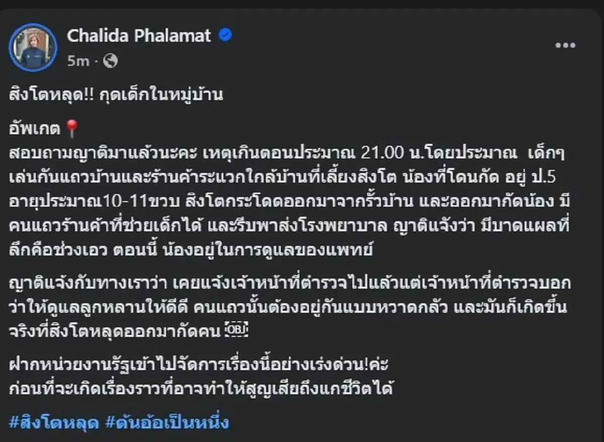 เรื่องใหญ่ สิงโต ของคนดัง หลุดจากบ้าน จู่โจมกัด เด็ก ป.5