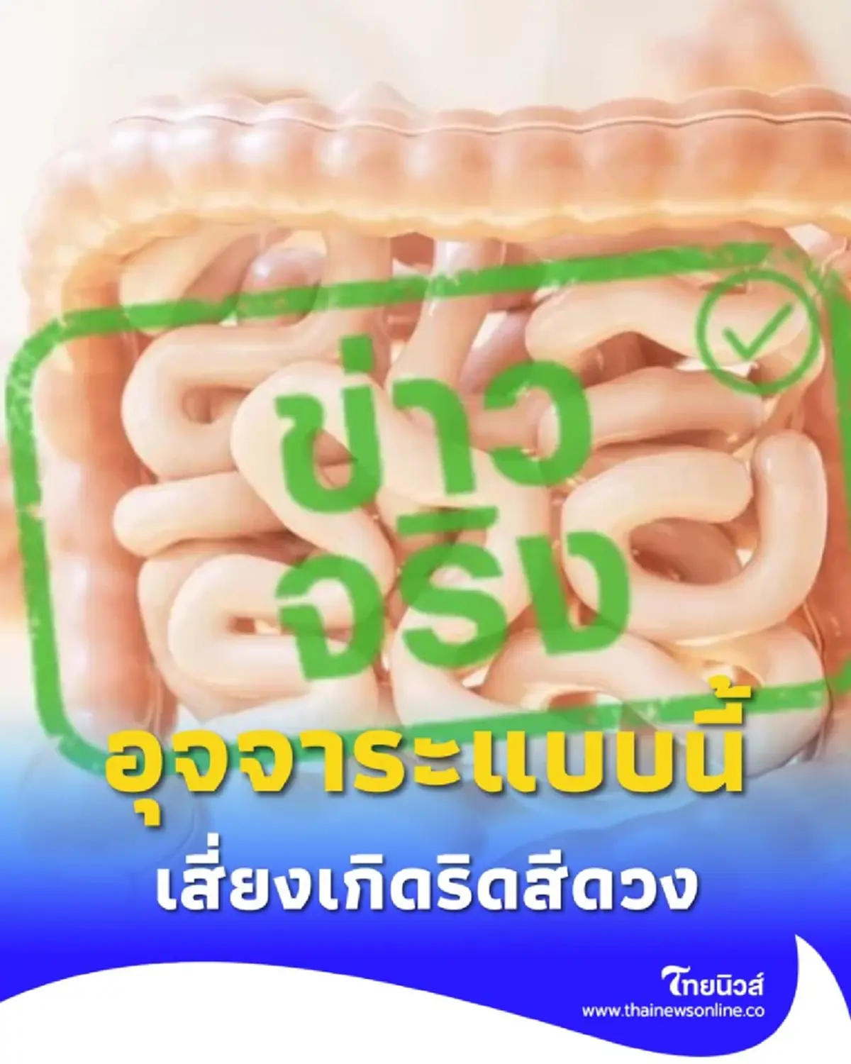 สัญญาณเตือนสุขภาพ อุจจาระขาดเป็นช่วง เสี่ยงอะไรบ้าง