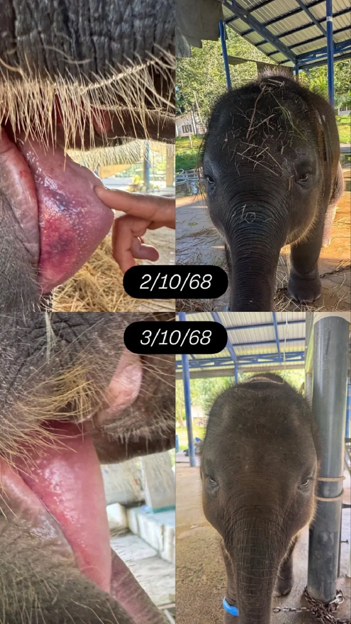 ข่าวดี อัปเดต น้องต้นหนาว ล่าสุด ยอมเลยหัวใจนักสู้ของจริง