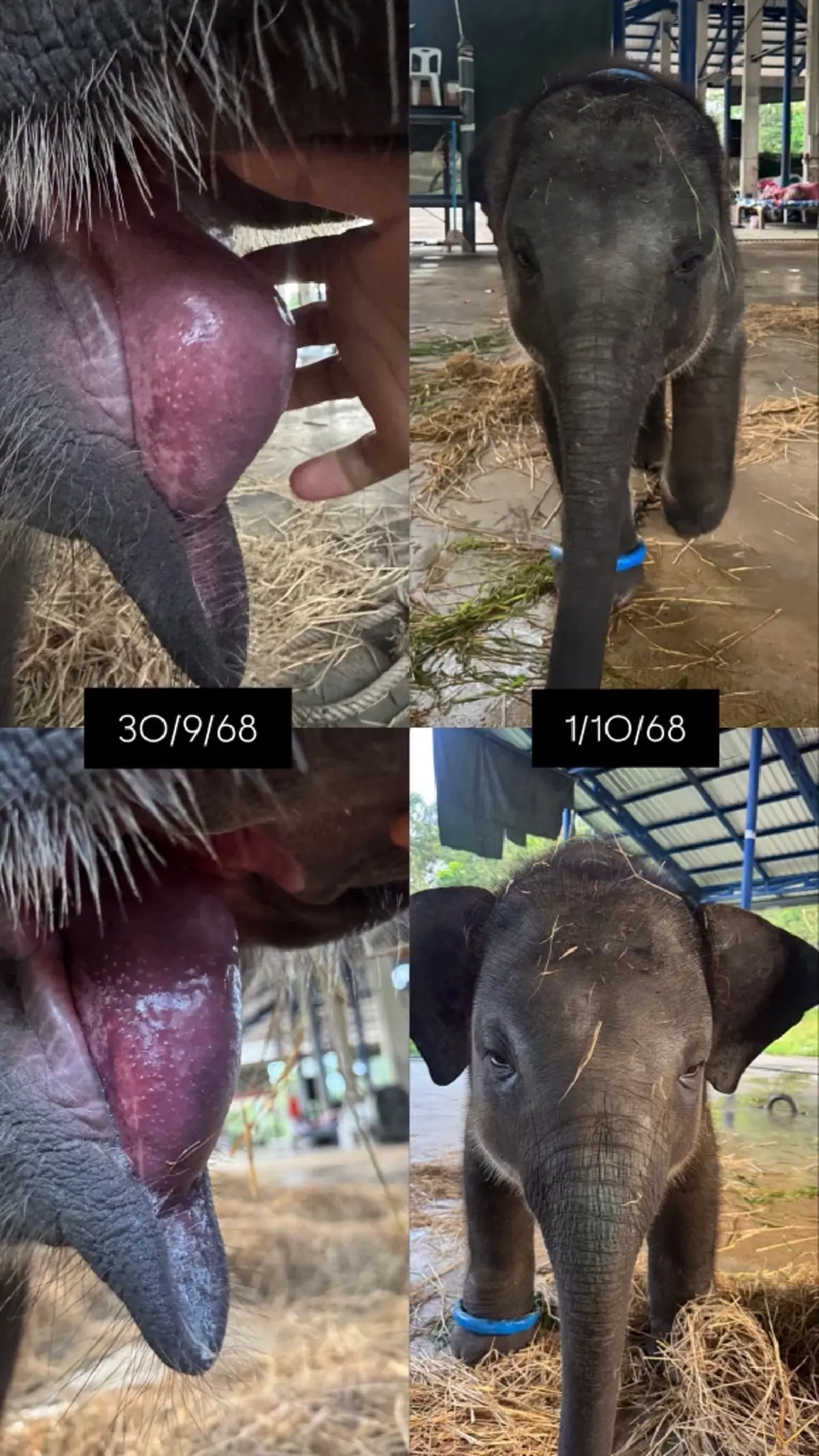 สงสารจับใจ น้องต้นหนาว อาการล่าสุด เห็นภาพยิ่งหดหู่