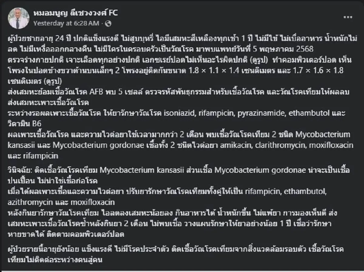 เตือน ผู้ป่วยไอ มีเสมหะเหลืองทุกวัน มา 1 ปี สุดท้ายเจอต้นตอ เต็ม ๆ 