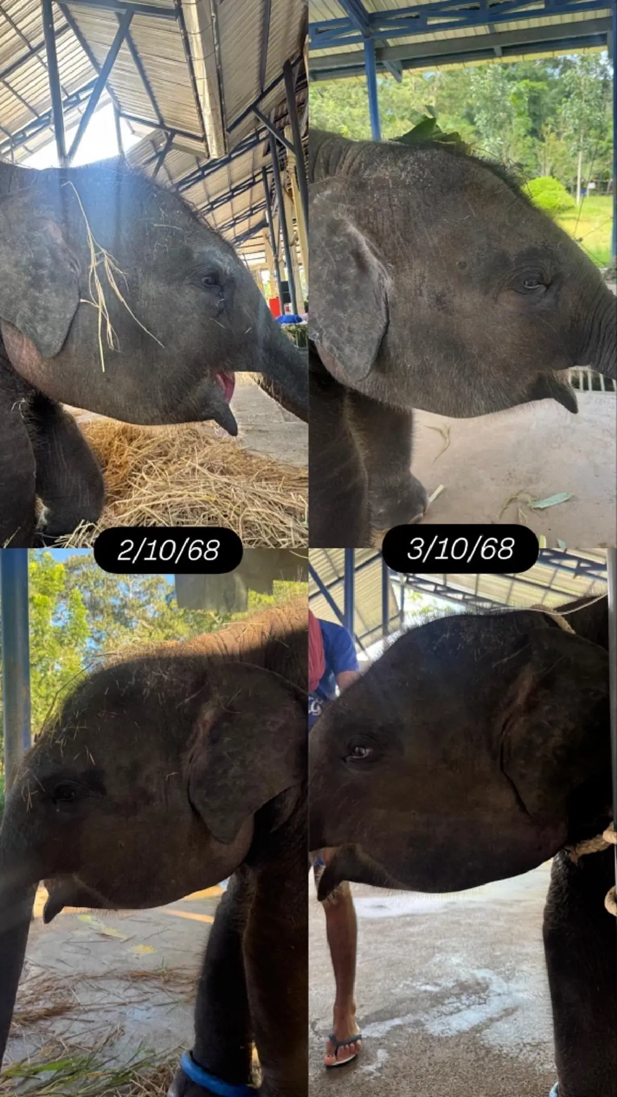 ข่าวดี อัปเดต น้องต้นหนาว ล่าสุด ยอมเลยหัวใจนักสู้ของจริง